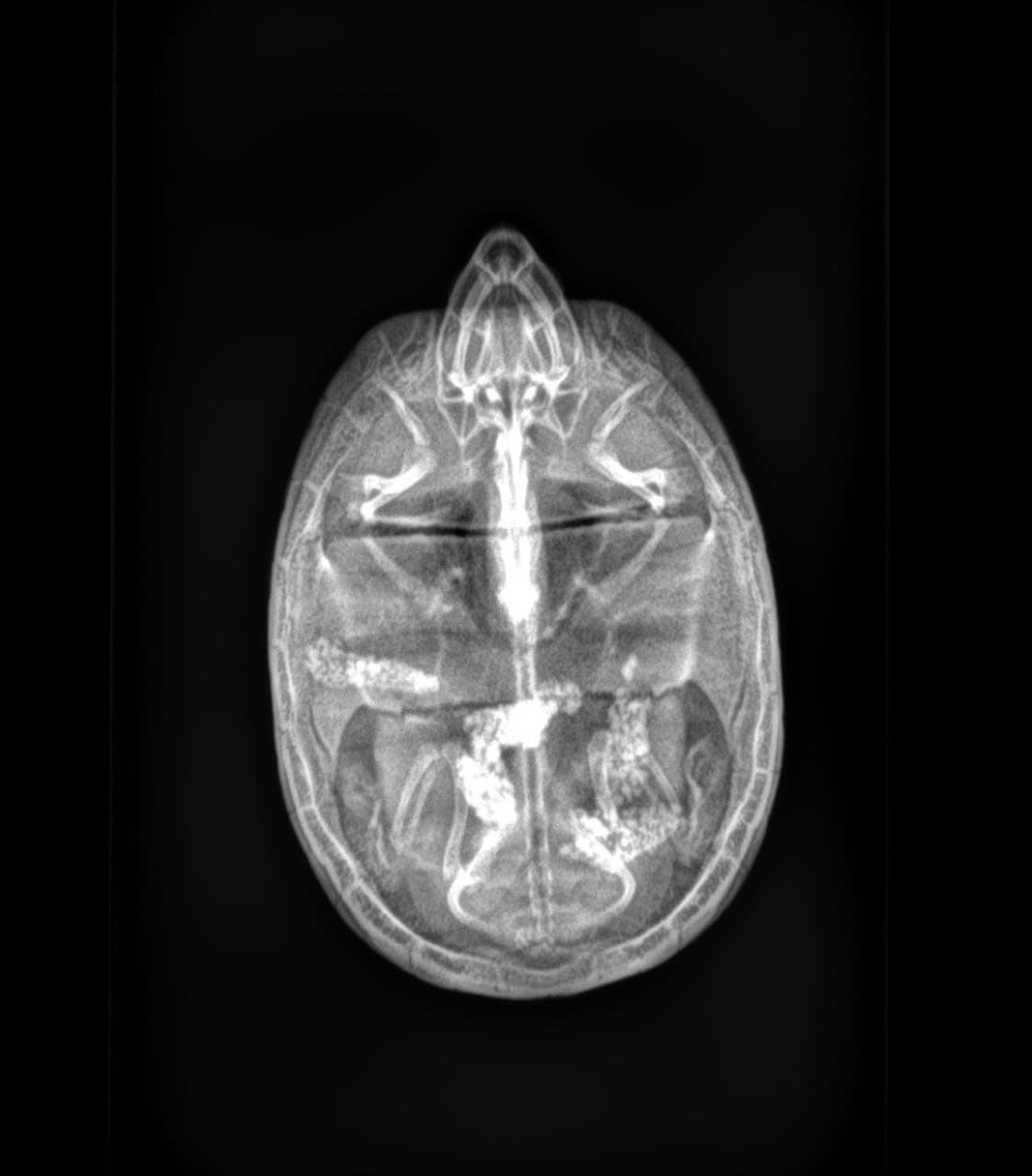 Scanner & Imagerie